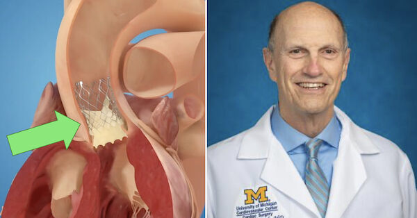 Doctor Q&A: 5 Must-Know Facts About TAVR for Aortic Valve Patients
