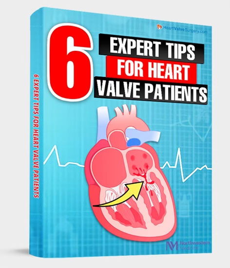 6 Expert Tips For Heart Valve Patients