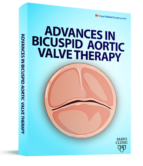 Advances in Bicuspid Aortic Valve Therapy eBook Cover