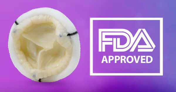 Medical Breakthrough: Epic Plus Heart Valve Gets FDA Approval