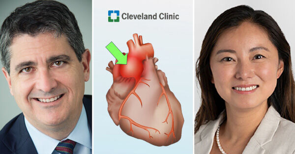 aortic-valves-aneurysms-interactions