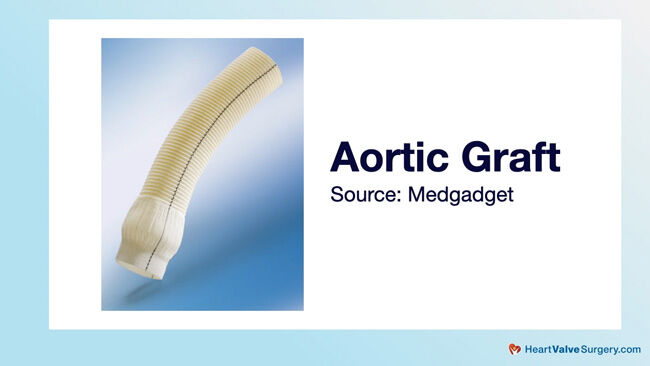 Dacron Aortic Graft