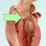 aorta-root-carving