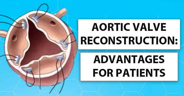 Aortic Valve Reconstruction Surgery: Patient Advantages