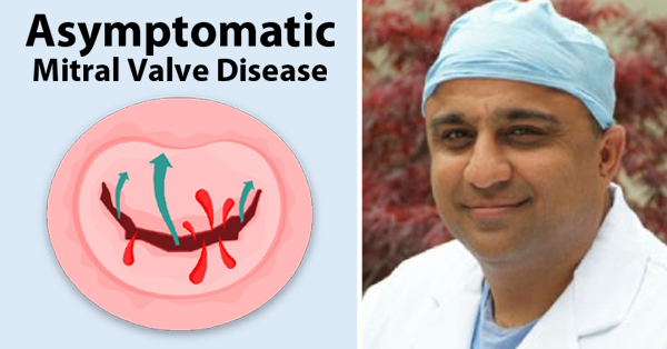 risks-benefits-asymptomatic-mitral-valve