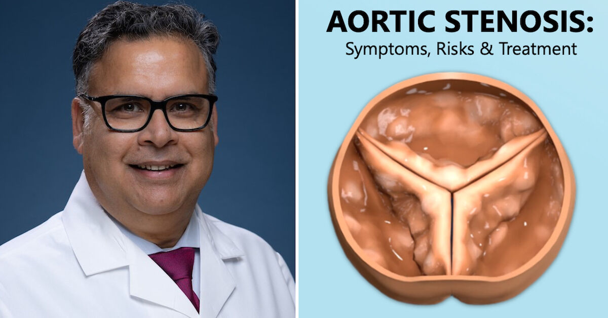 Cardiologist Q&A: Aortic Stenosis Symptoms, Risks & Treatment