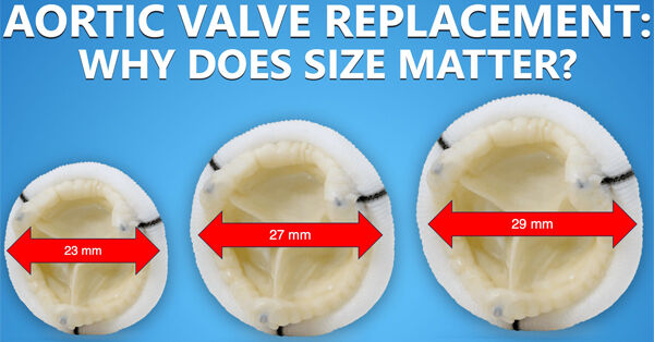 aortic-valve-replacement-sizing-tavr