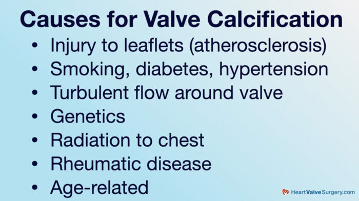 stroke-risk-heart-valve-calcification-doctor-q-a