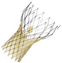 CoreValve Gets Accelerated FDA Approval for High Risk Patients