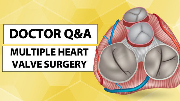 Doctor Q&A: Minimally-Invasive Multiple Heart Valve Surgery