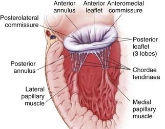 Primary vs. Secondary Mitral Regurgitation: 5 Facts to Know