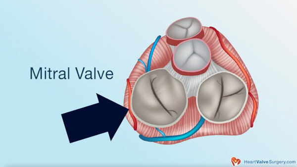 Atrial Fibrillation: A Concern for Heart Valve Patients?