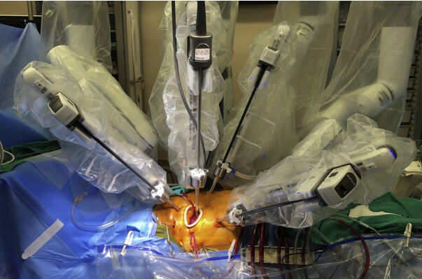 robotic surgery heart valve replacement