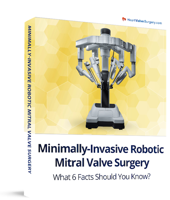 Robotic Mitral Valve Surgery eBook