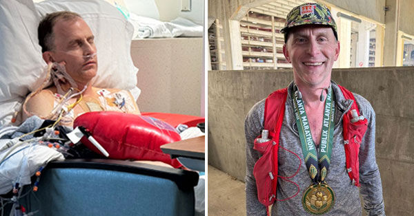 Marathon Runner After Aortic Valve Replacement Surgery