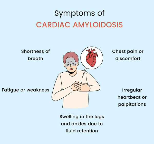 Amyloidosis Symptoms