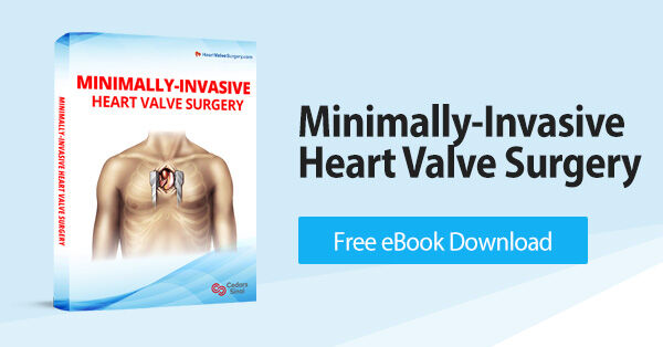 Minimally-Invasive Heart Valve Surgery eBook