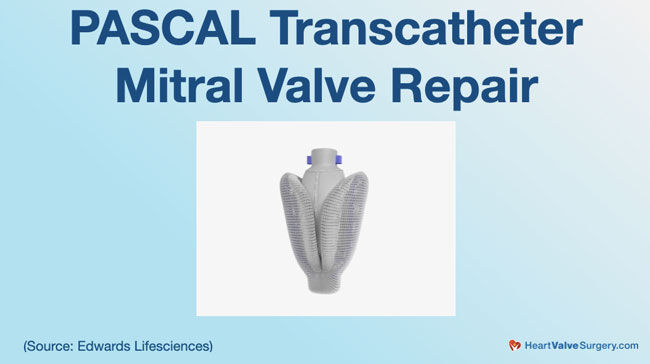 Pascal Transcatheter Mitral Valve Repair