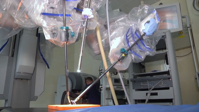 Robotic Mitral Valve Surgery Arms