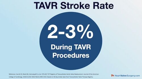 Transcatheter Aortic Valve Replacement (TAVR) Stroke Rate