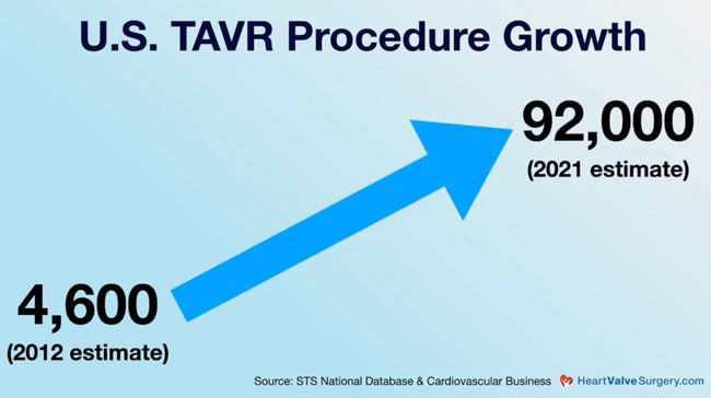 United States TAVR Procedure Growth