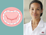 Surgeon Q&A: Mitral Valve Repair Insights with Dr. Joanna Chikwe