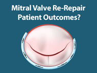 Doctor Q&A: Patient Outcomes For Mitral Valve Re-Repairs